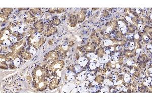 Detection of IFNb in Human Stomach Tissue using Monoclonal Antibody to Interferon Beta (IFNb) (IFNB1 抗体)