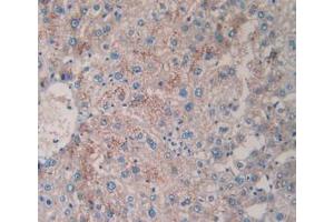 IHC-P analysis of Human Liver Tissue, with DAB staining. (TPSAB1 抗体  (AA 161-262))