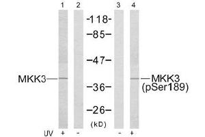 Image no. 3 for anti-Mitogen-Activated Protein Kinase Kinase 3 (MAP2K3) (pSer189) antibody (ABIN196862) (MAP2K3 抗体  (pSer189))