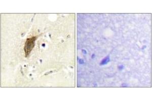 Immunohistochemistry analysis of paraffin-embedded human brain, using Myosin regulatory light chain 2 (Phospho-Ser18) Antibody. (MYL9 抗体  (pSer18))