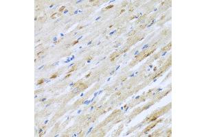 Immunohistochemistry of paraffin-embedded rat heart using STRN antibody at dilution of 1:100 (x40 lens). (Striatin 抗体)