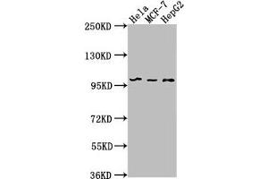 Western Blot Positive WB detected in: Hela whole cell lysate, MCF-7 whole cell lysate, HepG2 whole cell lysate All lanes: EIF4G2 antibody at 1:1000 Secondary Goat polyclonal to rabbit IgG at 1/50000 dilution Predicted band size: 103, 99 kDa Observed band size: 99 kDa