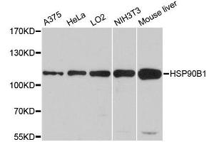 Western blot analysis of extracts of various cell lines, using HSP90B1 antibody. (GRP94 抗体  (AA 550-650))