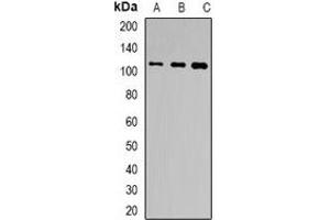 Western blot analysis of TSHR expression in Hela (A), HepG2 (B), HT29 (C) whole cell lysates. (TSH receptor 抗体)