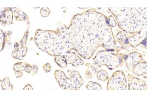 Detection of DSG3 in Human Placenta Tissue using Polyclonal Antibody to Desmoglein 3 (DSG3) (Desmoglein 3 抗体  (AA 858-999))
