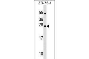 NXNL1 Antibody (Center) (ABIN1538700 and ABIN2849312) western blot analysis in ZR-75-1 cell line lysates (35 μg/lane). (NXNL1 抗体  (AA 94-121))