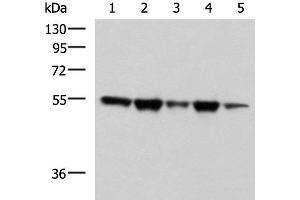 Western blot analysis of A172 Hela HepG2 K562 and PC3 cell lysates using FKBP5 Polyclonal Antibody at dilution of 1:600 (FKBP5 抗体)