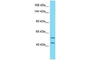 Host:  Rabbit  Target Name:  TTC7A  Sample Type:  Stomach Tumor lysates  Antibody Dilution:  1. (TTC7A 抗体  (N-Term))