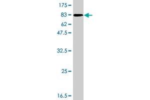 Western Blotting (WB) image for anti-rho-Related BTB Domain Containing 3 (RHOBTB3) (AA 1-611) antibody (ABIN524792)