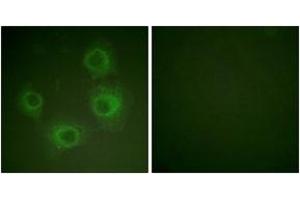 Immunofluorescence analysis of HuvEc cells, using NMDAR2A/B (Phospho-Tyr1246/1252) Antibody. (NMDAR2A + 2B 抗体  (pTyr1246))