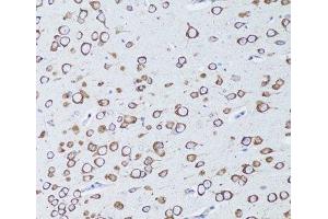 Immunohistochemistry of paraffin-embedded Mouse brain using TNFRSF11A Polyclonal Antibody at dilution of 1:100 (20x lens). (TNFRSF11A 抗体)