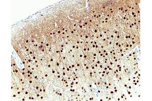 Pyrimidal cells in rat cortex, formalin-fixed paraffin embedded tissue, no pre-treatment, 20X (CAMK4 抗体  (AA 1-241))
