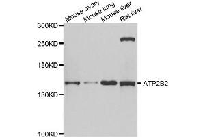 Western blot analysis of extracts of various cell lines, using ATP2B2 antibody. (ATP2B2 抗体)