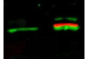 Western Blotting (WB) image for anti-V-Akt Murine Thymoma Viral Oncogene Homolog 1 (AKT1) (pSer473) antibody (ABIN349614)