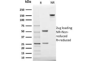 SDS-PAGE Analysis Purified StAR Mouse Monoclonal Antibody (STAR/2140). (STAR 抗体  (AA 39-108))