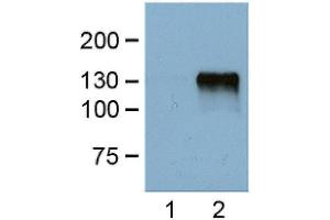 1:1000 (1 ug/ml) antibody dilution probed against HEK 293 cells transfected with DYKDDDDK-tagged protein vector; unstranfected (1) and transfected (2). (DYKDDDDK Tag 抗体)