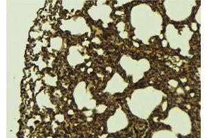 Immunohistochemistry (IHC) image for anti-Cyclin-Dependent Kinase 9 (CDK9) (Internal Region) antibody (ABIN6260723)