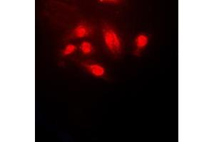 Immunofluorescent analysis of Cofilin staining in HeLa cells. (Cofilin 抗体  (N-Term))