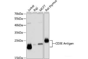 Western blot analysis of extracts of various cell lines using CD3E Antigen Polyclonal Antibody at dilution of 1:1000. (CD3 epsilon 抗体)