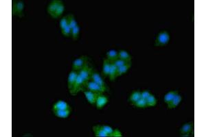 Immunofluorescent analysis of HepG2 cells using ABIN7172487 at dilution of 1:100 and Alexa Fluor 488-congugated AffiniPure Goat Anti-Rabbit IgG(H+L) (BTF3 抗体  (AA 48-206))