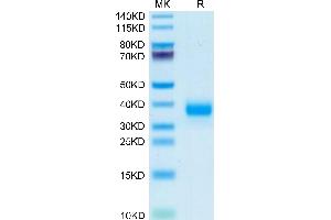 Mouse FOLR4/Juno on Tris-Bis PAGE under reduced condition.