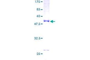 Image no. 1 for Slow Skeletal Troponin I (TNNI1) (AA 1-187) protein (GST tag) (ABIN1323277)