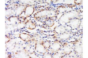 Paraformaldehyde-fixed, paraffin embedded rat kidney tissue, Antigen retrieval by boiling in sodium citrate buffer(pH6) for 15min, Block endogenous peroxidase by 3% hydrogen peroxide for 30 minutes, Blocking buffer (normal goat serum) at 37°C for 20min, Antibody incubation with Rabbit Anti-IGF1R (Tyr1165 + Tyr1166) Polyclonal Antibody, Unconjugated  at 1:500 overnight at 4°C, followed by a conjugated secondary and DAB staining (IGF1R 抗体  (pTyr1165, pTyr1166))