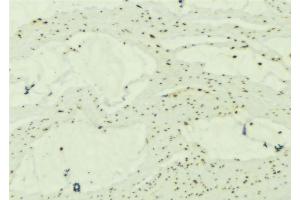 ABIN6277244 at 1/100 staining Mouse muscle tissue by IHC-P. (SNCG 抗体  (C-Term))