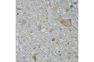 Immunohistochemistry of paraffin-embedded mouse brain using CALML5 antibody (ABIN5974468) at dilution of 1/100 (40x lens). (CALML5 抗体)