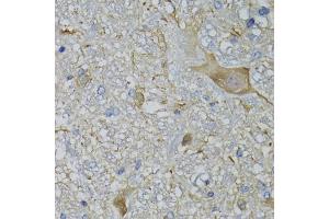 Immunohistochemistry of paraffin-embedded mouse brain using CALML5 antibody (ABIN5974468) at dilution of 1/100 (40x lens).