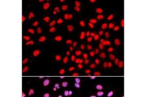 Immunofluorescence analysis of U2OS cells using IKZF1 Polyclonal Antibody (IKZF1 抗体)