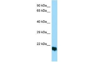 Host: Rabbit Target Name: MPLKIP Sample Type: HepG2 Whole Cell lysates Antibody Dilution: 1. (TTDN1 抗体  (Middle Region))