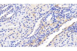 Detection of mTOR in Human Kidney Tissue using Monoclonal Antibody to Serine/threonine-protein kinase mTOR (mTOR) (MTOR 抗体  (AA 2226-2488))