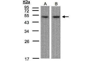WB Image Sample(30 μg of whole cell lysate) A:Hep G2, B:Raji, 12% SDS PAGE antibody diluted at 1:1500 (AFT7 抗体  (C-Term))