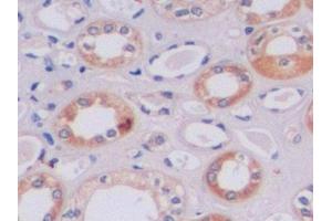 Detection of TIMP2 in Human Kidney Tissue using Polyclonal Antibody to Tissue Inhibitors Of Metalloproteinase 2 (TIMP2) (TIMP2 抗体  (AA 27-220))
