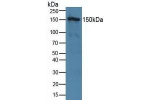Detection of TJP2 in Human Hela Cells using Polyclonal Antibody to Tight Junction Protein 2 (TJP2) (TJP2 抗体  (AA 307-669))