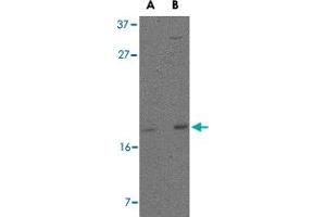 Western blot analysis of DPPA3 in 293 cell lysate with DPPA3 polyclonal antibody  at (A) 1 and (B) 2 ug/mL . (DPPA3 抗体  (C-Term))