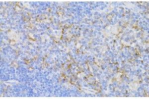 Immunohistochemistry of paraffin-embedded Mouse thymus using CD3E Antigen Polyclonal Antibody at dilution of 1:100 (40x lens). (CD3 epsilon 抗体)