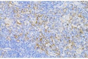 Immunohistochemistry of paraffin-embedded Mouse thymus using CD3E Antigen Polyclonal Antibody at dilution of 1:100 (40x lens). (CD3 epsilon 抗体)