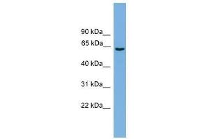 Western Blot showing SLCO1A2 antibody used at a concentration of 1-2 ug/ml to detect its target protein. (SLCO1A2 抗体  (Middle Region))