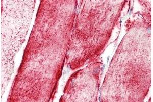 Human Skeletal Muscle: Formalin-Fixed, Paraffin-Embedded (FFPE) (STOX1 抗体  (C-Term))