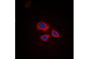 Immunofluorescent analysis of RNF144A staining in HepG2 cells. (RNF144A 抗体  (Center))