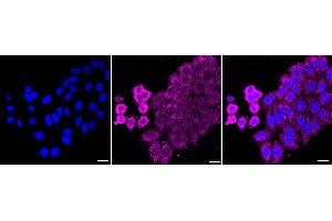 Immunocytochemical staining of HepG2 cells with Ferredoxin 1 antibody (ABIN7798594), 1:1,000). (Recombinant Ferredoxin1 (FDX1) 抗体)