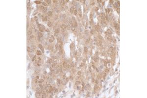 Immunohistochemistry (IHC) image for anti-Mitogen-Activated Protein Kinase-Activated Protein Kinase 5 (MAPKAPK5) (AA 423-473) antibody (ABIN7453731) (MAPKAP Kinase 5 抗体  (AA 423-473))