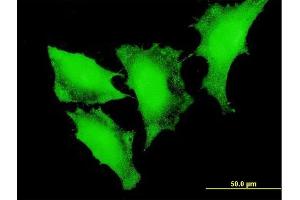 Immunofluorescence of monoclonal antibody to FOXO3 on HeLa cell. (FOXO3 抗体  (AA 361-460))