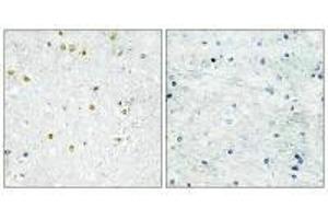 Immunohistochemistry analysis of paraffin-embedded human brain tissue using TRIM24 antibody. (TRIM24 抗体  (C-Term))