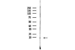 anti-Coiled-Coil-Helix-Coiled-Coil-Helix Domain Containing 2 (CHCHD2) (Internal Region) antibody