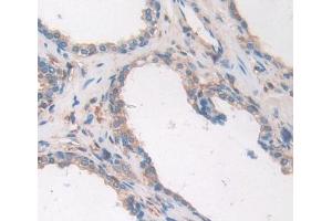 Used in DAB staining on fromalin fixed paraffin- embedded prostate gland tissue (ALOX12B 抗体  (AA 479-701))