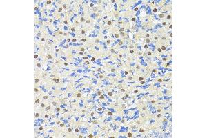 Immunohistochemistry (IHC) image for anti-Tripartite Motif Containing 27 (TRIM27) (AA 1-200) antibody (ABIN7269922)