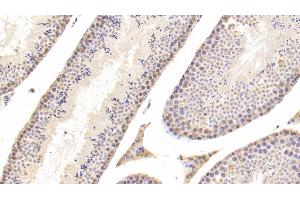 Detection of CTSD in Mouse Testis Tissue using Polyclonal Antibody to Cathepsin D (CTSD) (Cathepsin D 抗体  (AA 66-410))